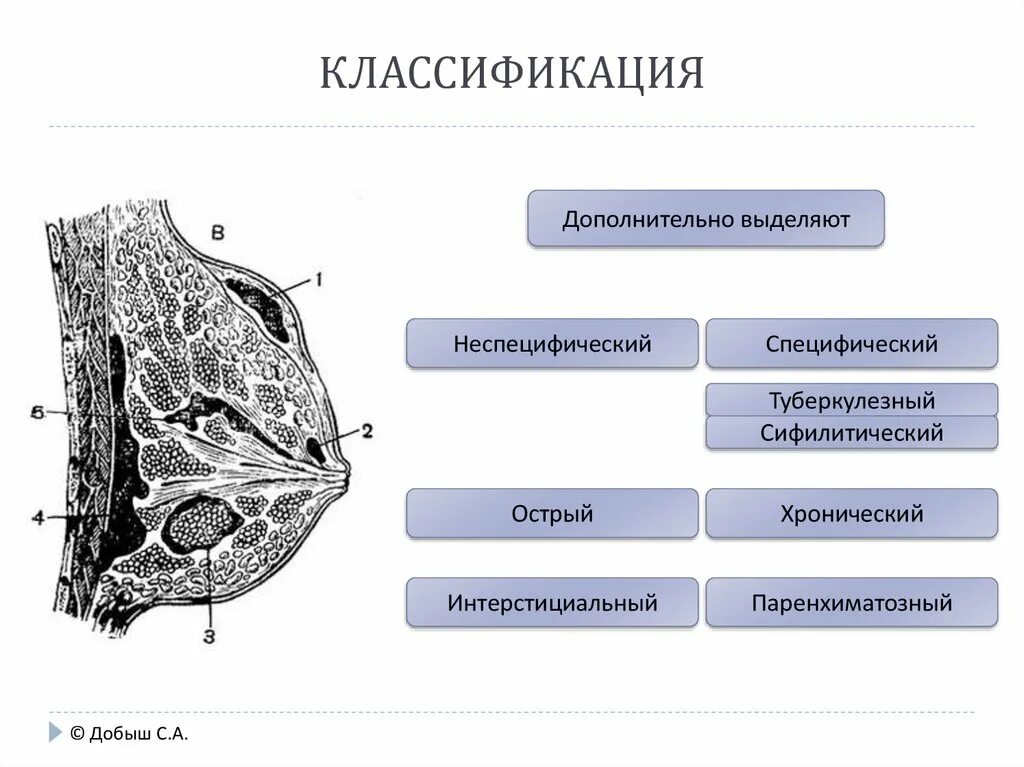 Мастит классификация. Паренхиматозный мастит. Мастит классификация маститов. Классификация лактационных маститов. Острый гнойный мастит