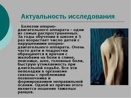 Заболевания опорно двигательной системы сообщение