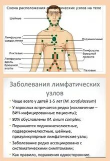 Болит неделю лимфоузел