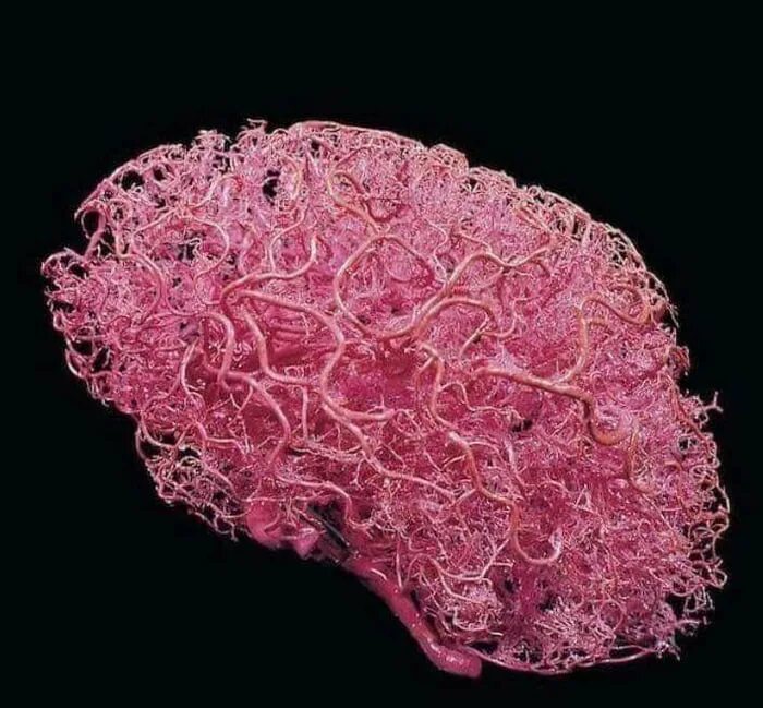 Brain 9