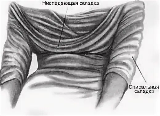 Складка на рисунке изображена