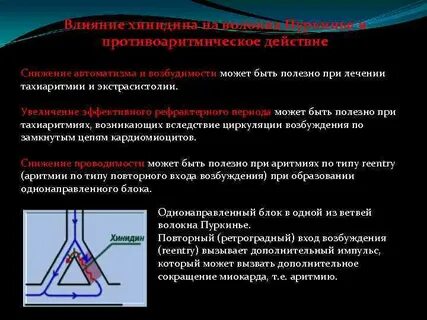 Повышенный автоматизм