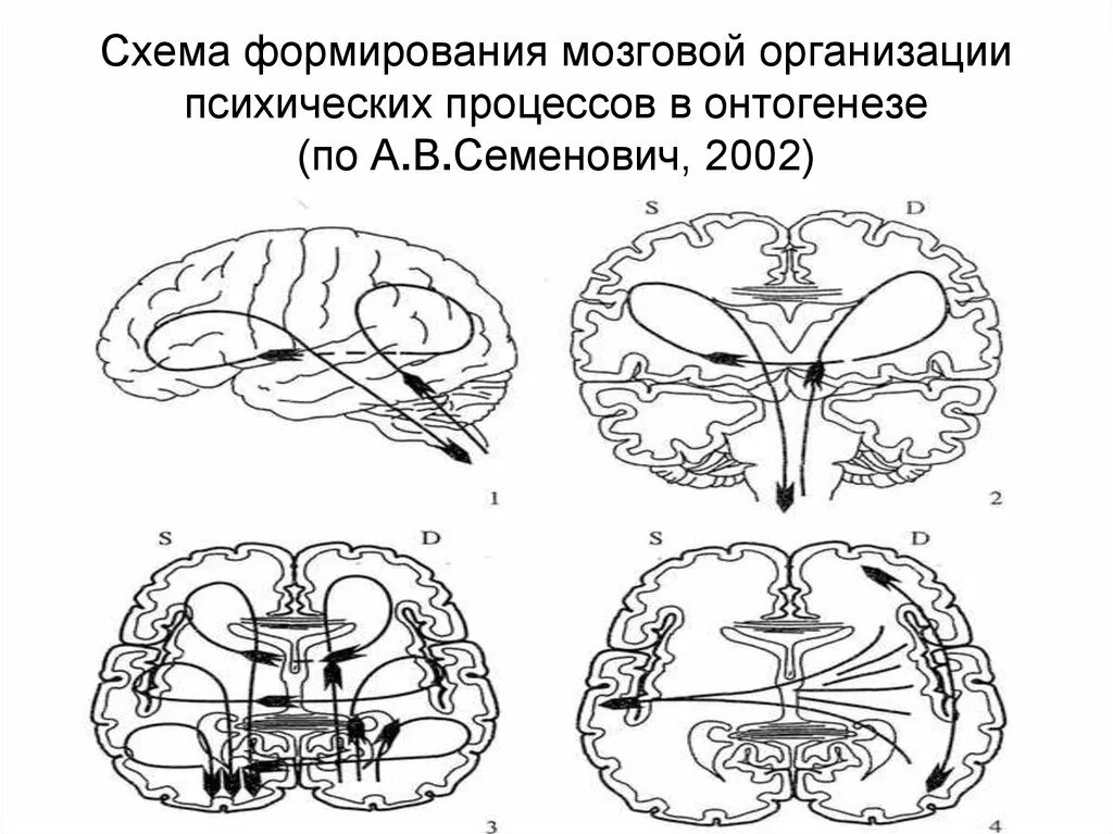 Межполушарное взаимодействие в онтогенезе. Межполушарная асимметрия мозга. Межполушарное взаимодействие в онтогенезе. Межполушарное взаимодействие. Межполушарное взаимодействие в онтогенезе.