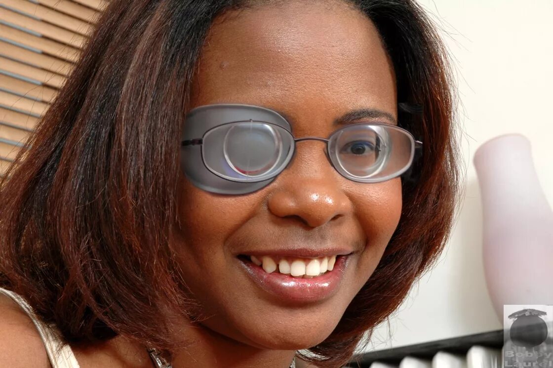 With one eye. With one eye. One eyed girl with eyepatch. High myopia glasses. With one eye.
