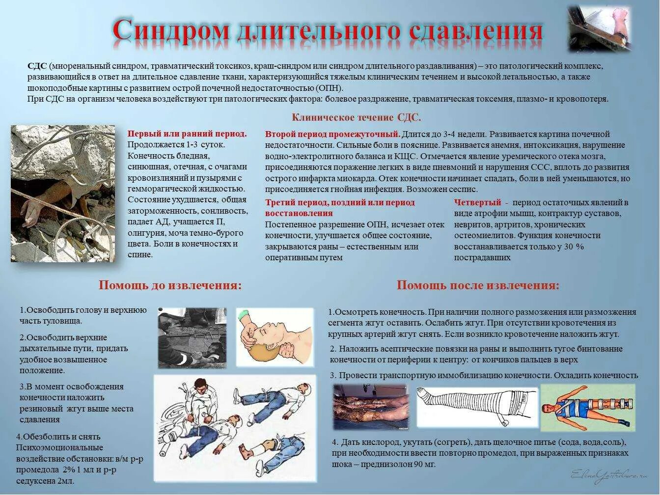 После освобождения конечности. Синдром длительного раздавливания первая помощь. Синдром длительного сдавления (краш-синдром). Оказание первой помощи при краш синдроме. Синдром длительного сдавливания ПМП.