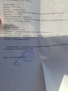 Эко заключение