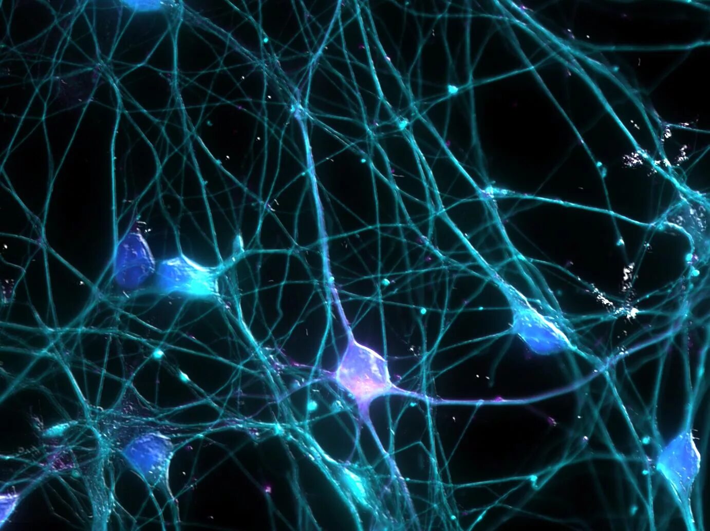 Нейросеть Нейроны. Гиппокампальные Нейроны. Нейронная сеть головного мозга человека. Моносенсорные Нейроны.