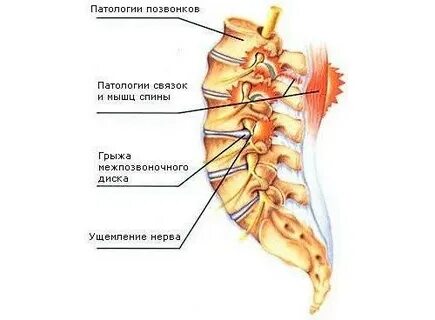 Крестово поясничный отдел