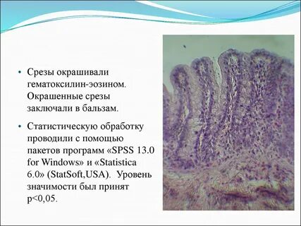Гематоксилин окрашивает