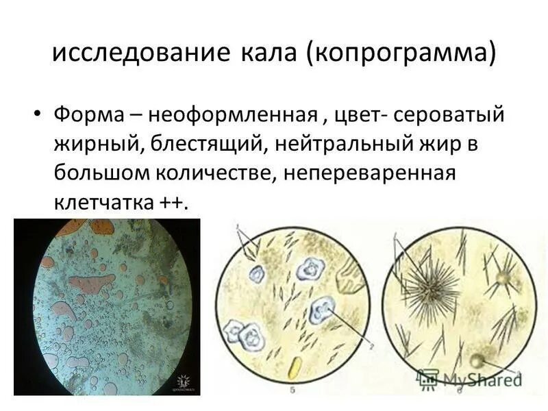 Растительная клетчатка в копрограмме