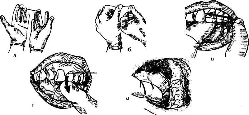 Обработка полости рта алгоритм. Обработка полости рта пациента. Обработка полости рта тяжелобольным. Чистка зубов тяжелобольному.