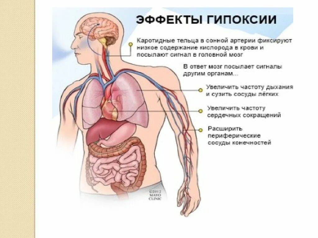 Гипоксия мозга у ребенка. Гипоксия кислородное голодание. Кислородное голодание у ребенка. Кислородное голодание картинки. Кислородное голодание тканей.