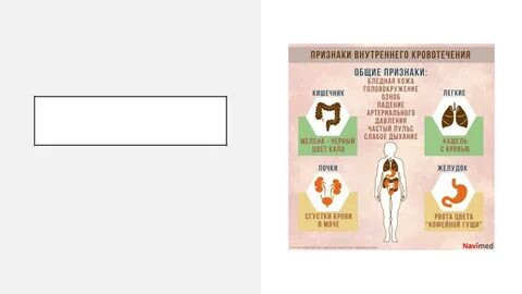 10 признаков внутреннего кровотечения