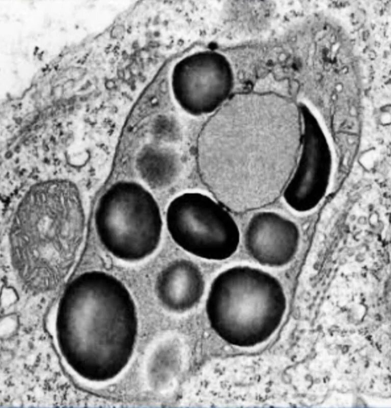 Хлоропласт электронная микроскопия. Лейкопласты микрофотография. Лейкопласты картофеля. Лейкопласты микрофотография. Лейкопласты микроскоп.