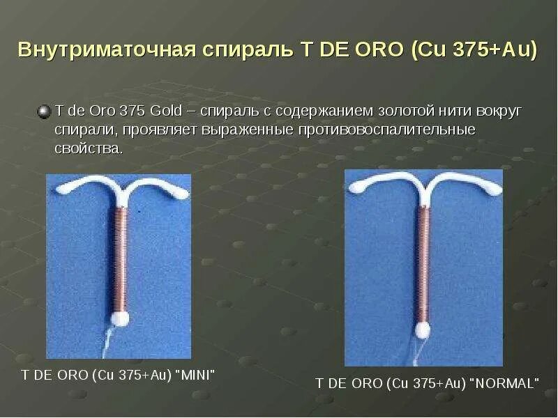 Как называется спираль. Противозачаточная спираль мультилоад. t de oro 375 gold спираль внутриматочная. multiload спираль внутриматочная. внутри матачнаяспираль.
