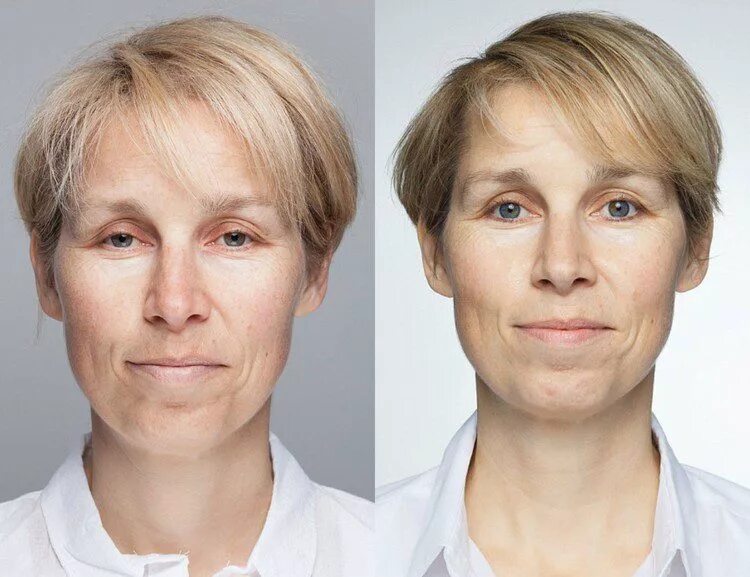 лицо до и после отказа от курения. кожа после отказа. лицо человека до и после курения. ботекс морщин. пропитое лицо женщины до и после.