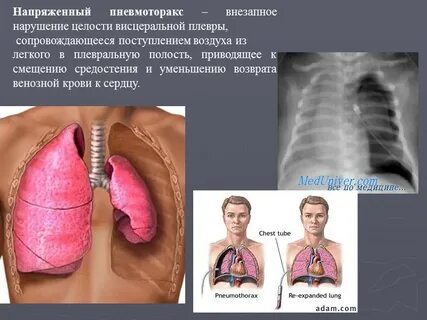 Внезапное нарушение