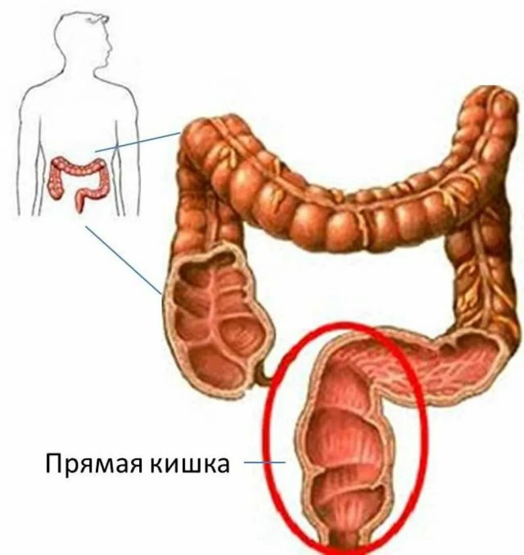 Трещина в кишечнике. Прямая кишка анатомия человека. Прямая кишка анатомия у мужчин Размеры. Строение прямой кишки и заднего прохода у мужчин. Анатомия толстой кишки и прямой кишки.
