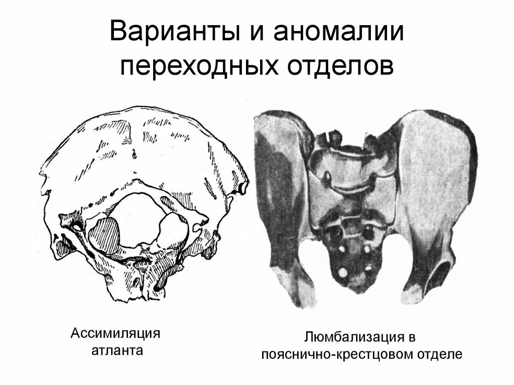 Аномалия перехода