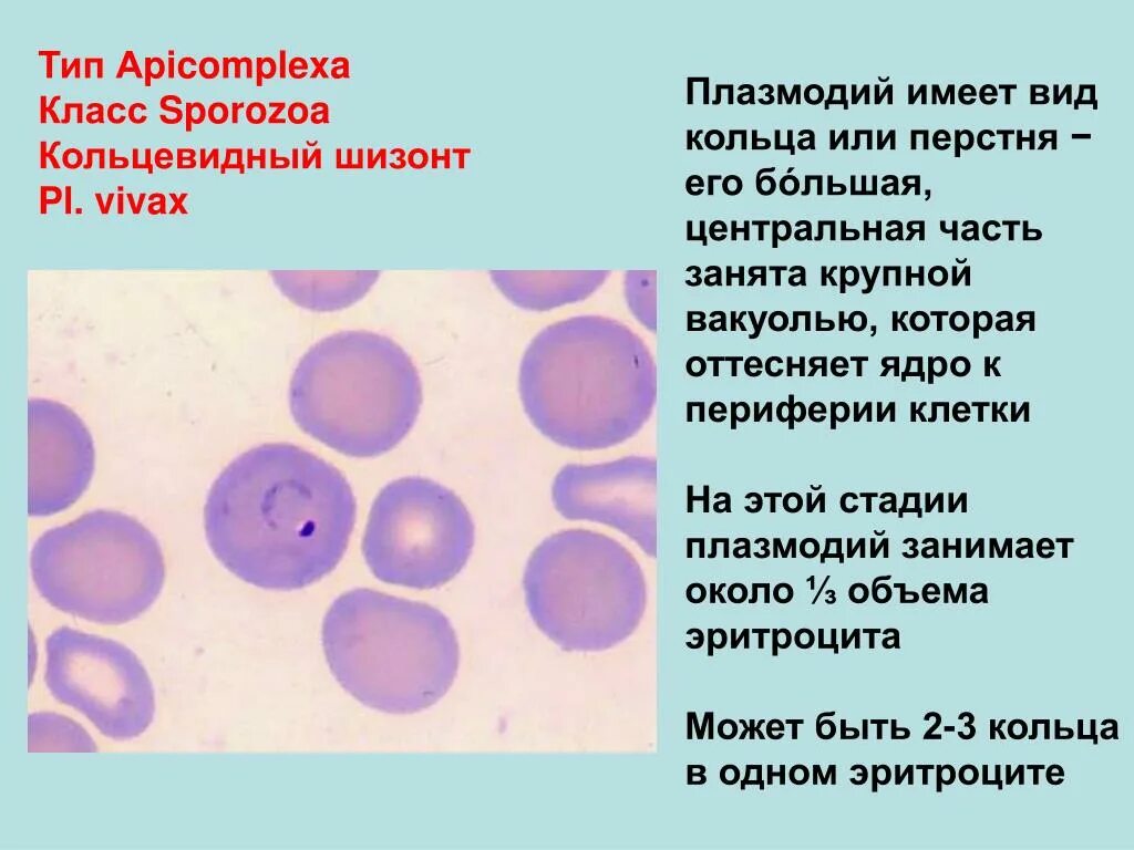 Плазмодий Vivax. Кольцевидный шизонт. Шизонт в стадии кольца. Форма кольца плазмодия. Шизонт это