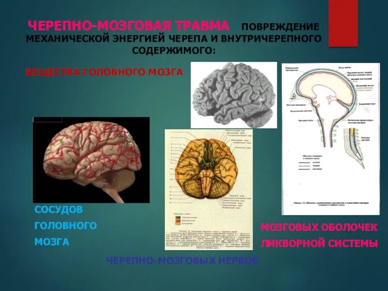 Туберкулез мозговых оболочек