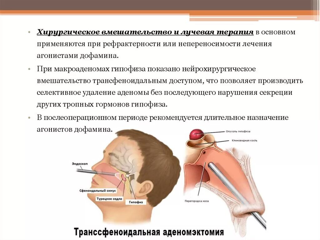 Аденома гипофиза удаление отзывы. Аденома гипофиза удаление отзывы. Микроаденома гипофиза симптомы. Психосоматика микроаденома гипофиза. Операция аденомы гипофиза через нос.