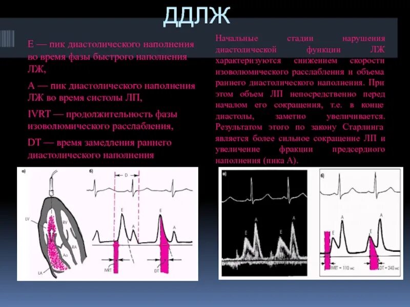 Типы нарушения диастолической функции
