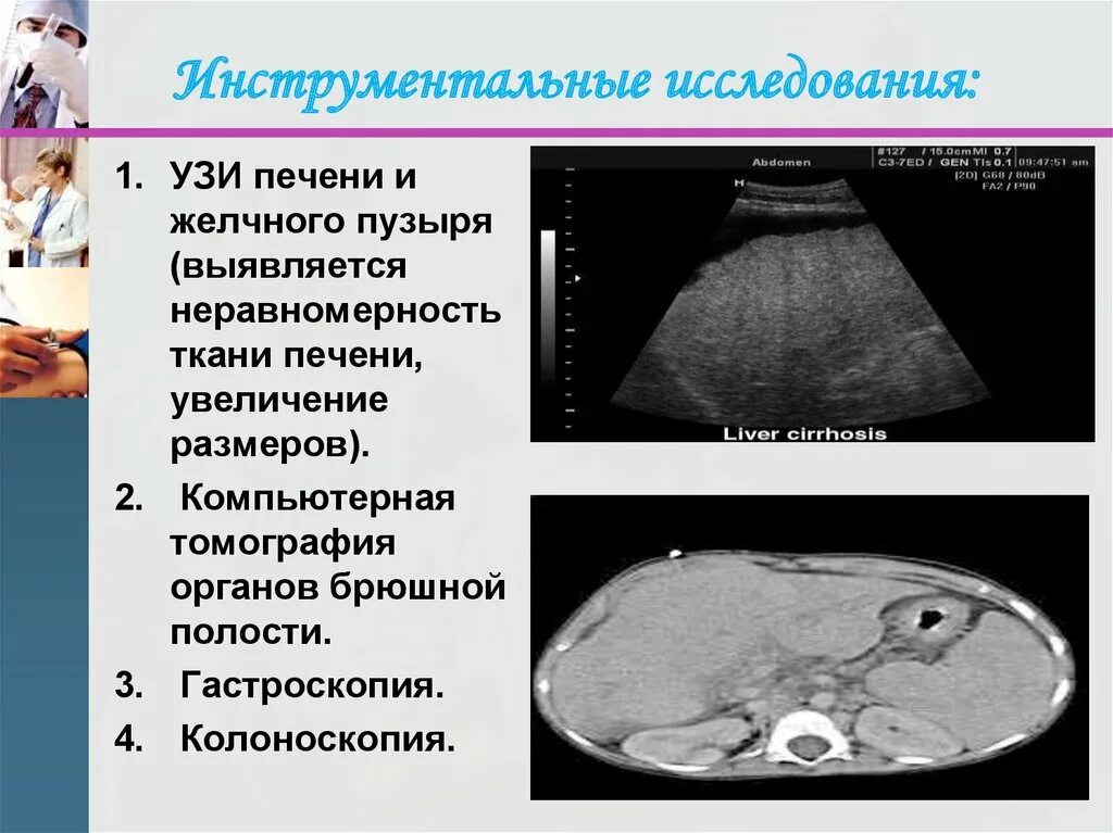 Размеры желчного пузыря у мужчин. УЗИ печени презентация. УЗИ печени слайдам.