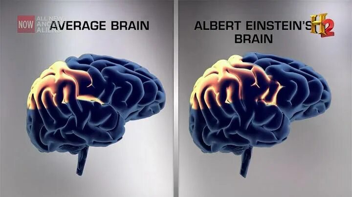 Мозг Эйнштейна. Мозг Эйнштейна и обычного человека. Brain vs brain