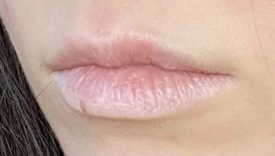 Бледные губы. Почему губы бледные. Почему губы бледные. Почему губы бледные. Бледные губы.