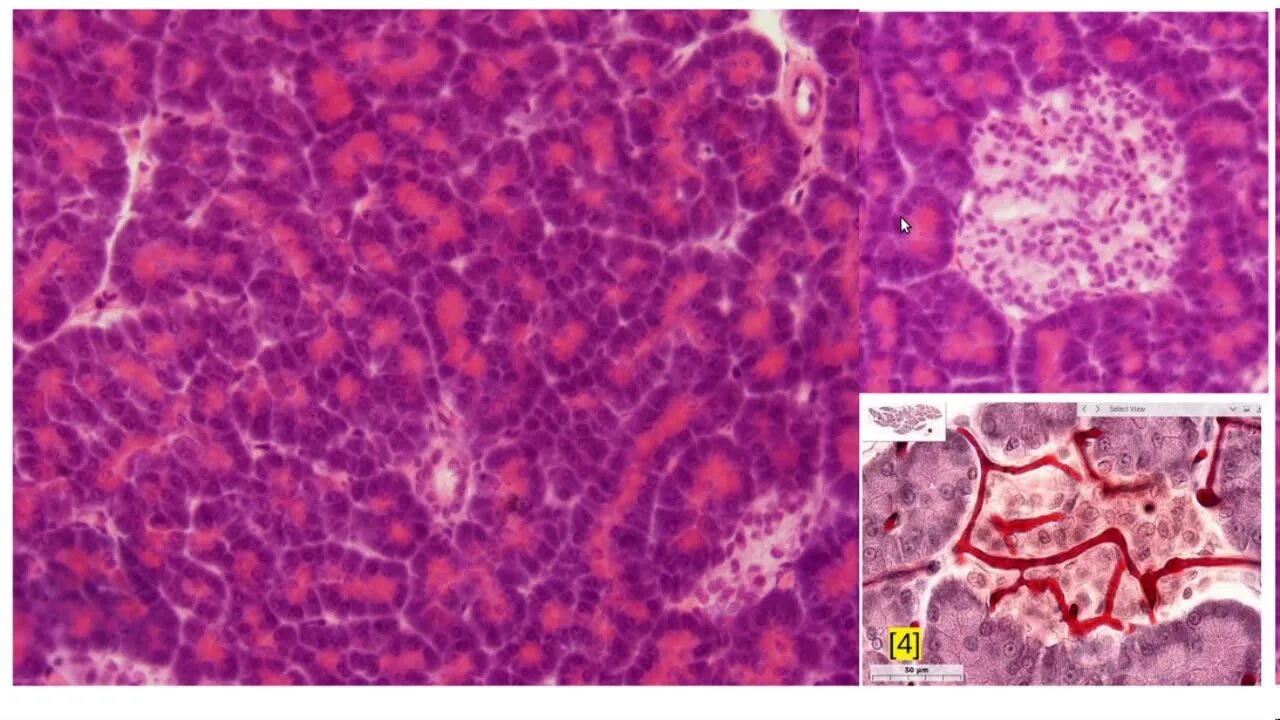 Эпителий печени и поджелудочной железы. Островки Лангерганса гистология препарат. Поджелудочная железа гистология препарат. Срез поджелудочной железы гистология. Панкреатический островок гистология.