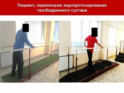 Снятие швов после эндопротезирования тазобедренного сустава