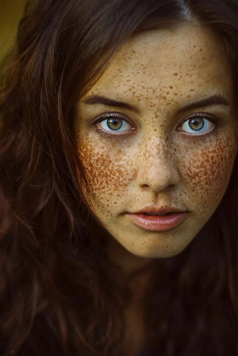 Freckles girl