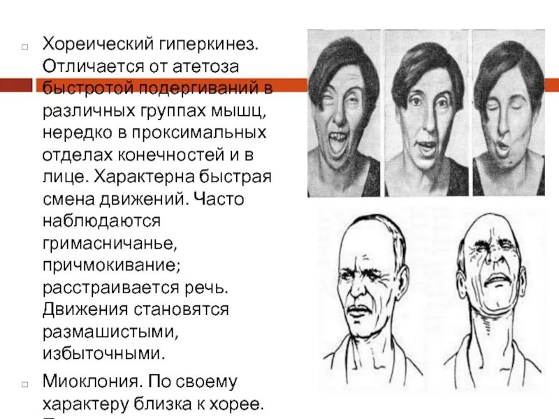 Болезнь непроизвольные движения
