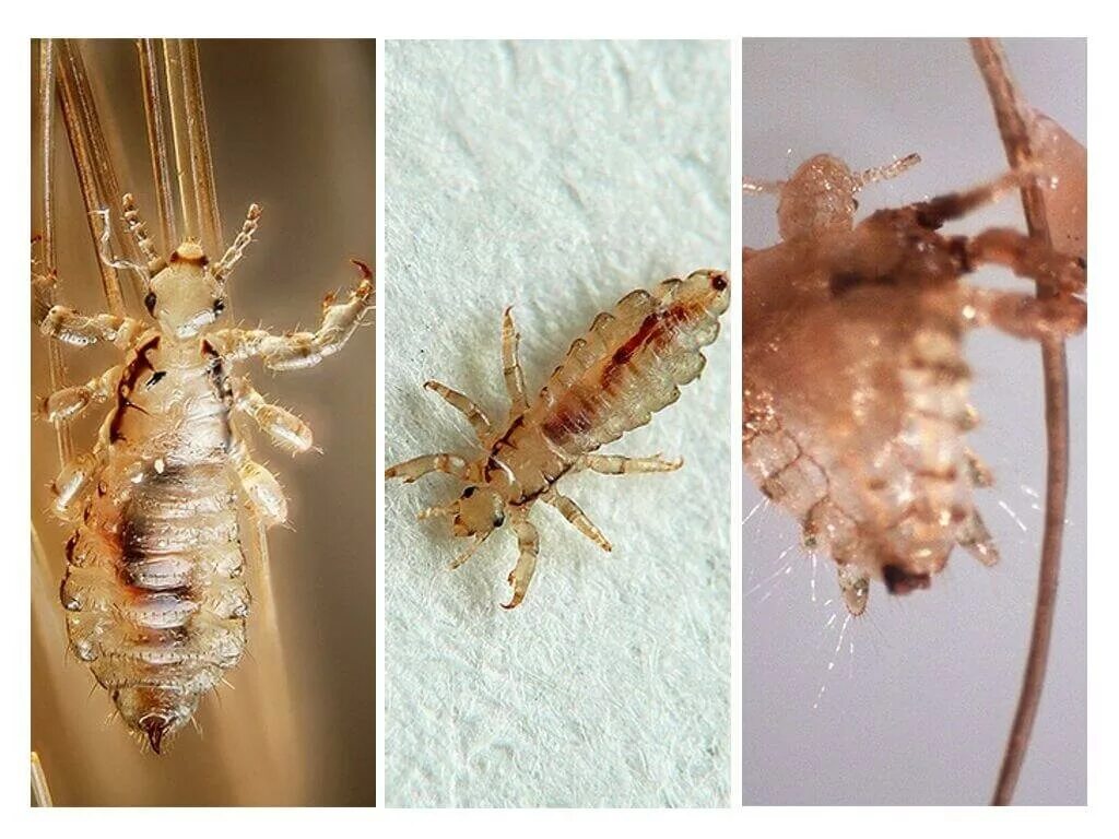 Головная вошь (Pediculus humanus capitis).