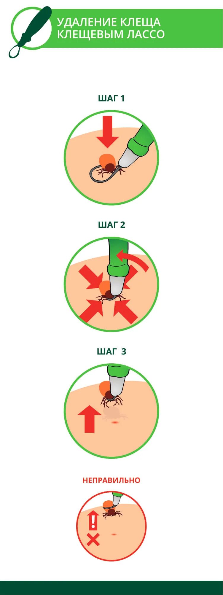 Исследование удаленного клеща. Приспособление для удаления клещей. Карточка для снятия клеща. Техника снятия клеща алгоритм.