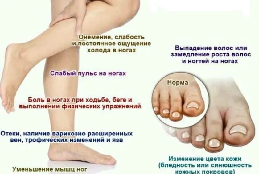 Отеки на ногах способы избавления. Избавление от отеков на ногах