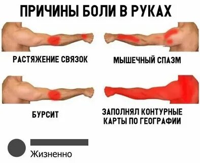 Отлежал руку причины