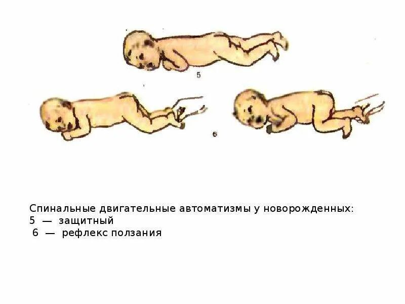 Врожденные ориентировочные рефлексы. Возрастные особенности условно-рефлекторной деятельности. Рефлексы сохранения и продолжения рода. Исследование постуральных рефлексов. Двигательные рефлексы новорожденных.