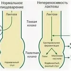 Непереносимость лактозы анализ цена. Ген mcm6. Лактозная кривая. Лактозная непереносимость как выглядит результат. Непереносимость лактозы mcm6; 4988235; -13910 c>t c/c.