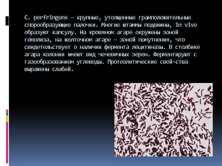 Возбудитель газовой гангрены антигенная структура. Газовая гангрена ботулизм. Классификация бактерий клостридии. Клостридиум перфрингенс. Клостридии перфрингенс микроскопия.