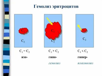 Гемолиз какой раствор