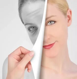 Skin ageing