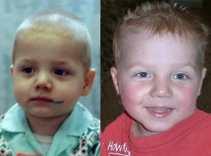 усыновленный ребенок до и после. дети до и после усыновления. до и после детдома. дети сироты до и после усыновления фото. удочеренные дети до и после.