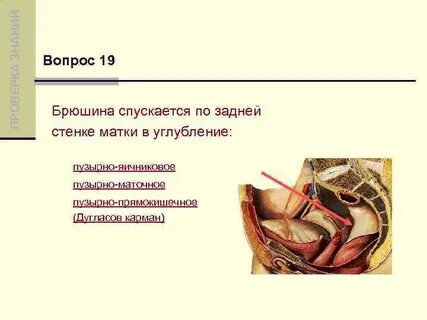 Брюшина матки