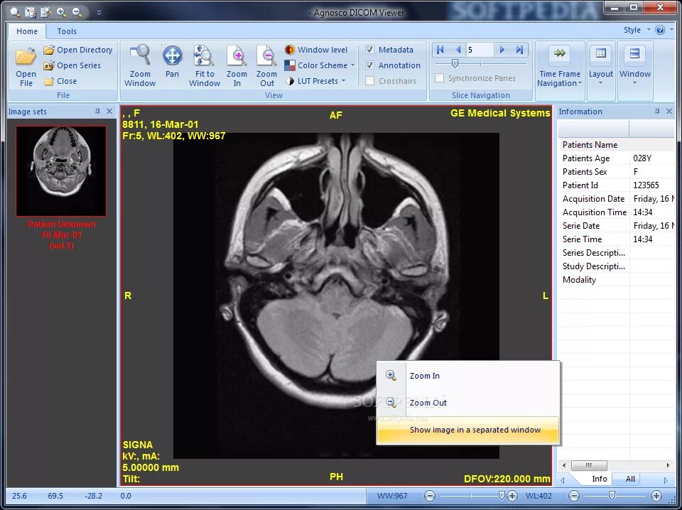 Dicom viewer. Программа philips dicom viewer. изображение dicom. dicom формат. dicom 3.0.