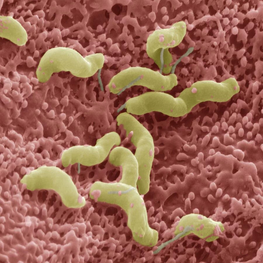 Хеликобактер пилори бактери. Бактерии хиликобакторпилари.