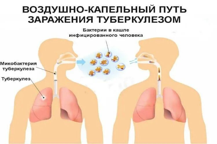 Мокрота передается. Воздушно капельный путь туберкулеза. Воздушно капельный путь заражения. Пути заражения туберкулезом. Пути передачи туберкулеза.