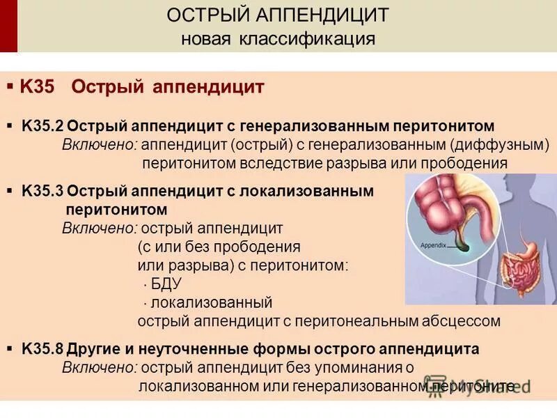 Антибиотики при аппендиците. Классификация острого аппендицита. Антибиотики при остром аппендиците. Препараты применяемые при остром аппендиците.