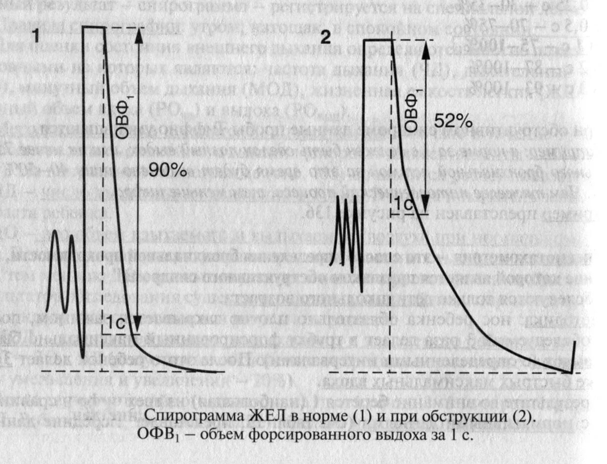 Данные спирографии